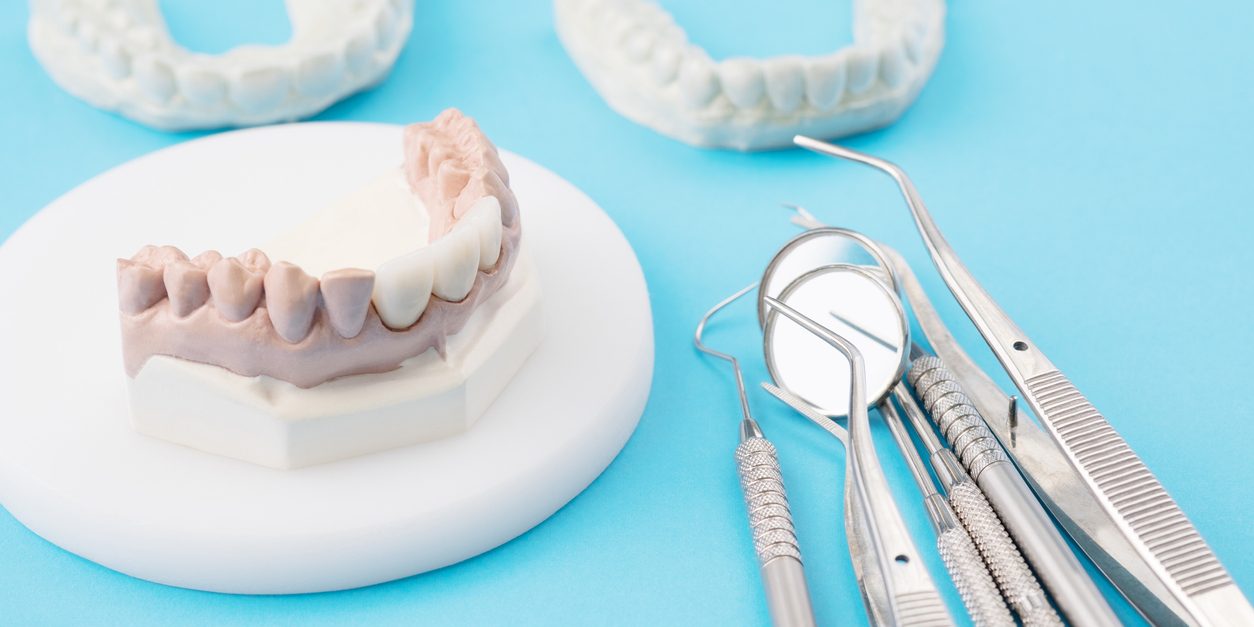 Perfecting Smiles with Precision: Composite Bonding's Rise in London