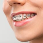 How Braces Influence Sleep Quality and Breathing Patterns
